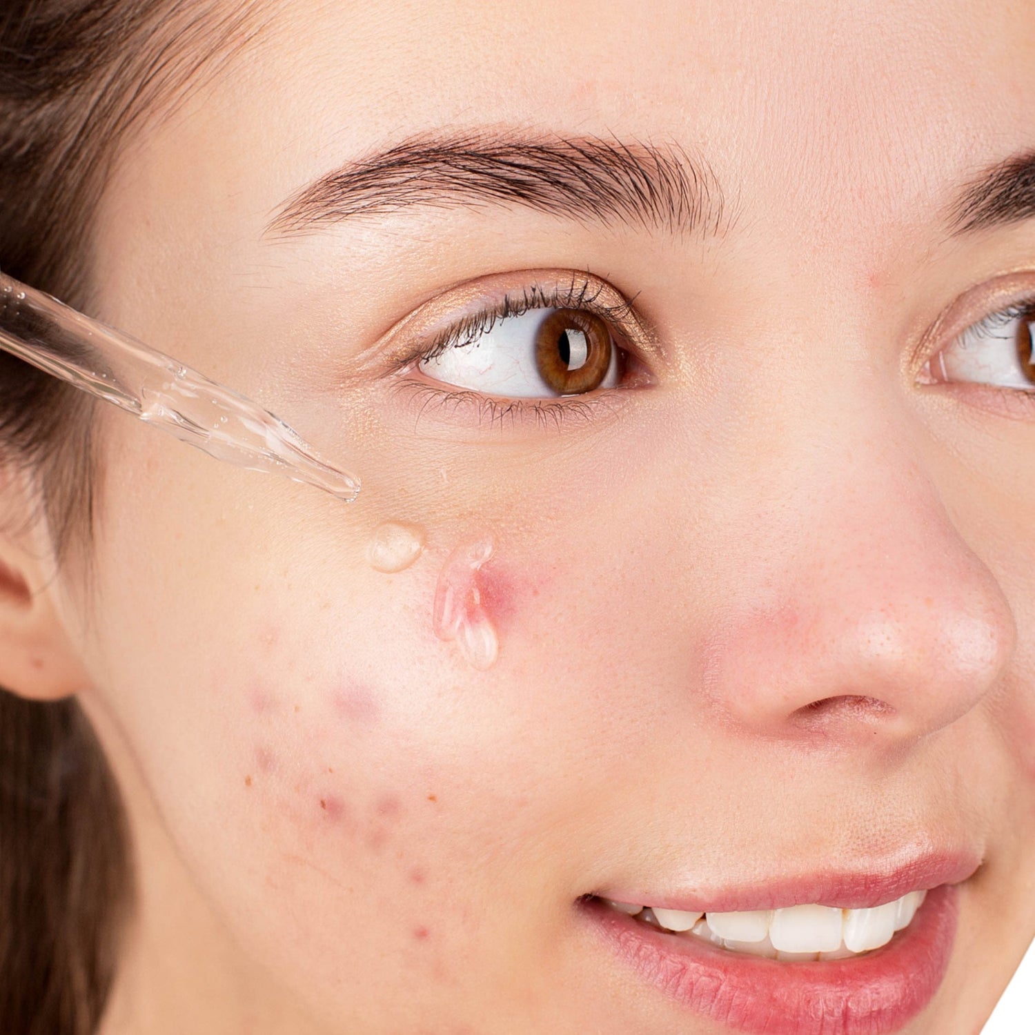 Oily & Acne Prone Skin